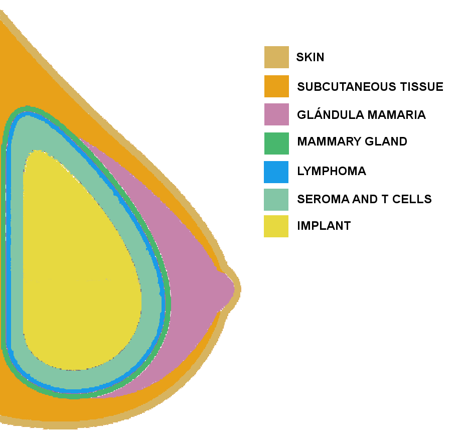 Breasat scheme